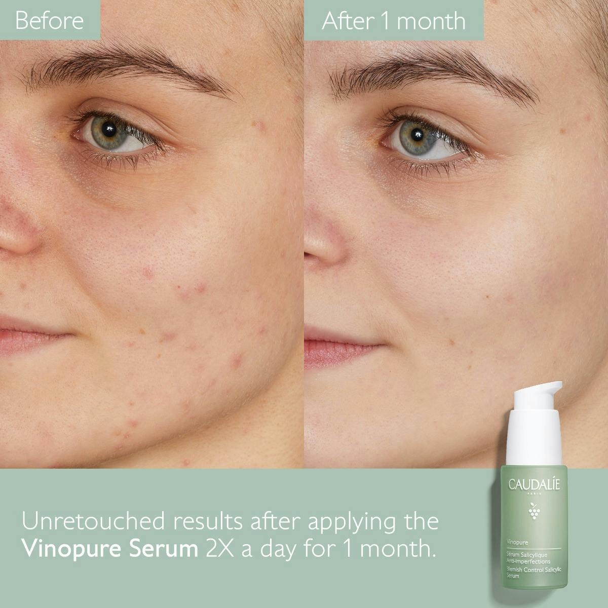 Natural Salicylic Acid Pore Minimizing Serum