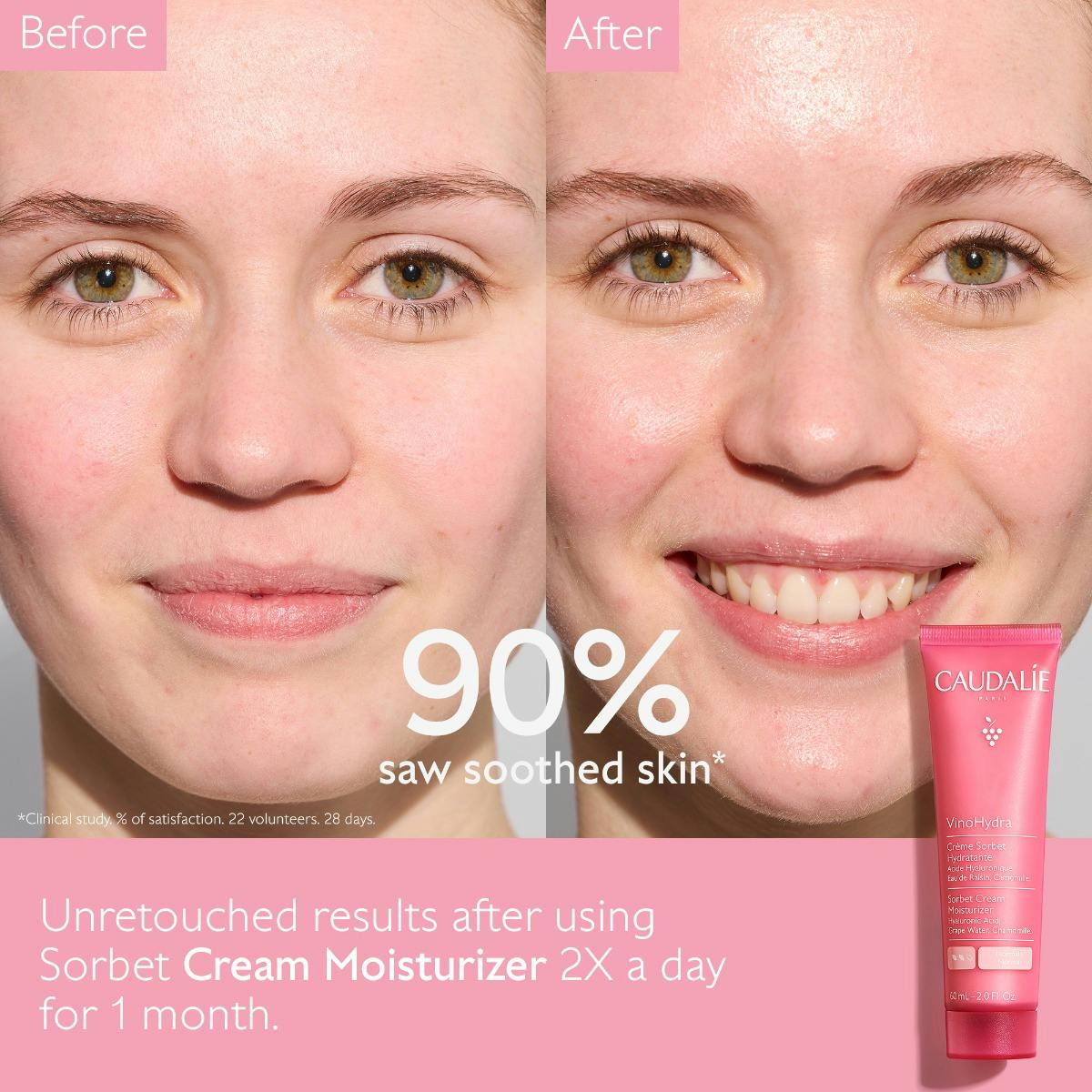Sorbet Cream Moisturizer with Hyaluronic Acid